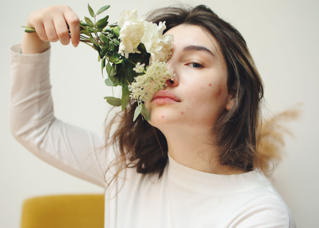 adult-acne-in-women