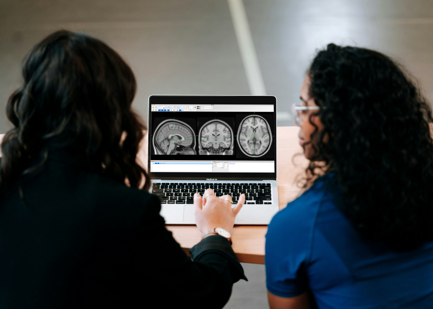 brain-health-women