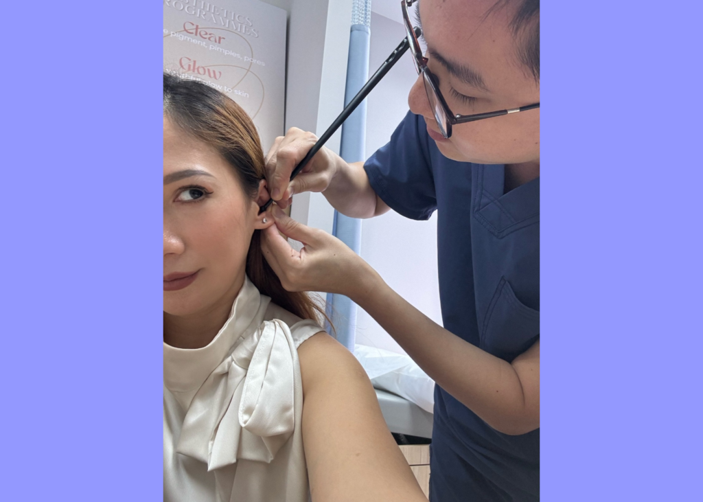Louisa Lim trying ear seeding for the first time at a TCM clinic