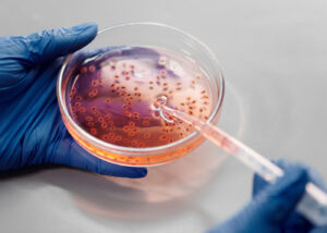 Bacteria in a petri dish | The great mitochondria makeover